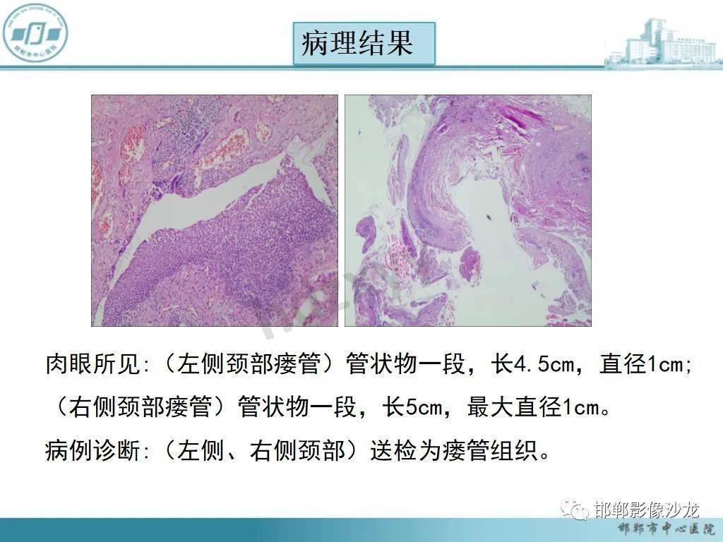 耳郭和耳廓的区别_区别耳廓耳郭的标志_耳廓和耳郭的区别