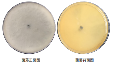 细菌构成的生命系统结构层次_细菌构成细胞的结构特点_细菌由什么构成