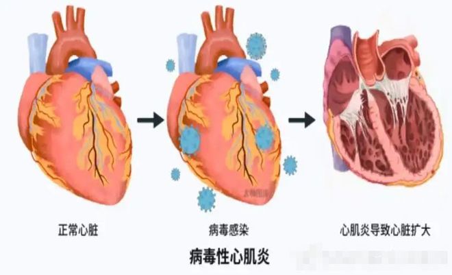 2024第二波疫情已经到来_疫情2024年_疫情到来的时间是多少